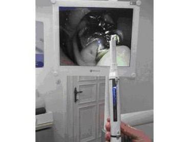 intraoral camera einstein stella